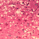 Microfotografía de tejido encefálico en un animal infectado con EEB. Foto: Wikipedia